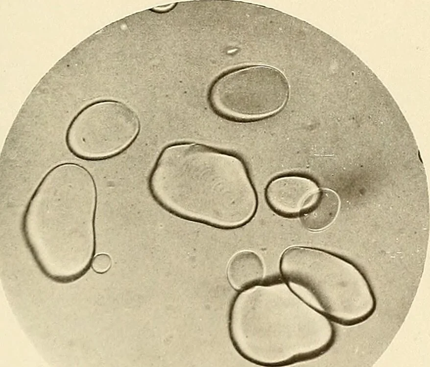 An illustration from A manual of practical hygiene for students, physicians, and health officers / By Charles Harrington., 1914, leaf 237