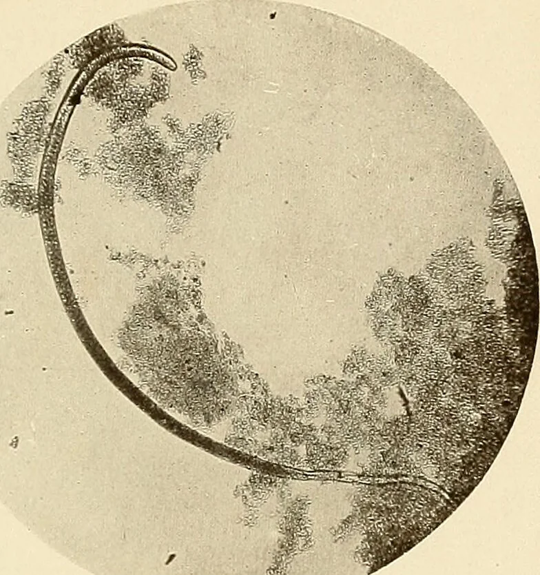 An illustration from A manual of practical hygiene for students, physicians, and health officers / By Charles Harrington., 1914, leaf 45