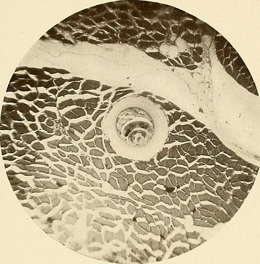 An illustration from A manual of practical hygiene for students, physicians, and health officers / By Charles Harrington., 1914, leaf 51