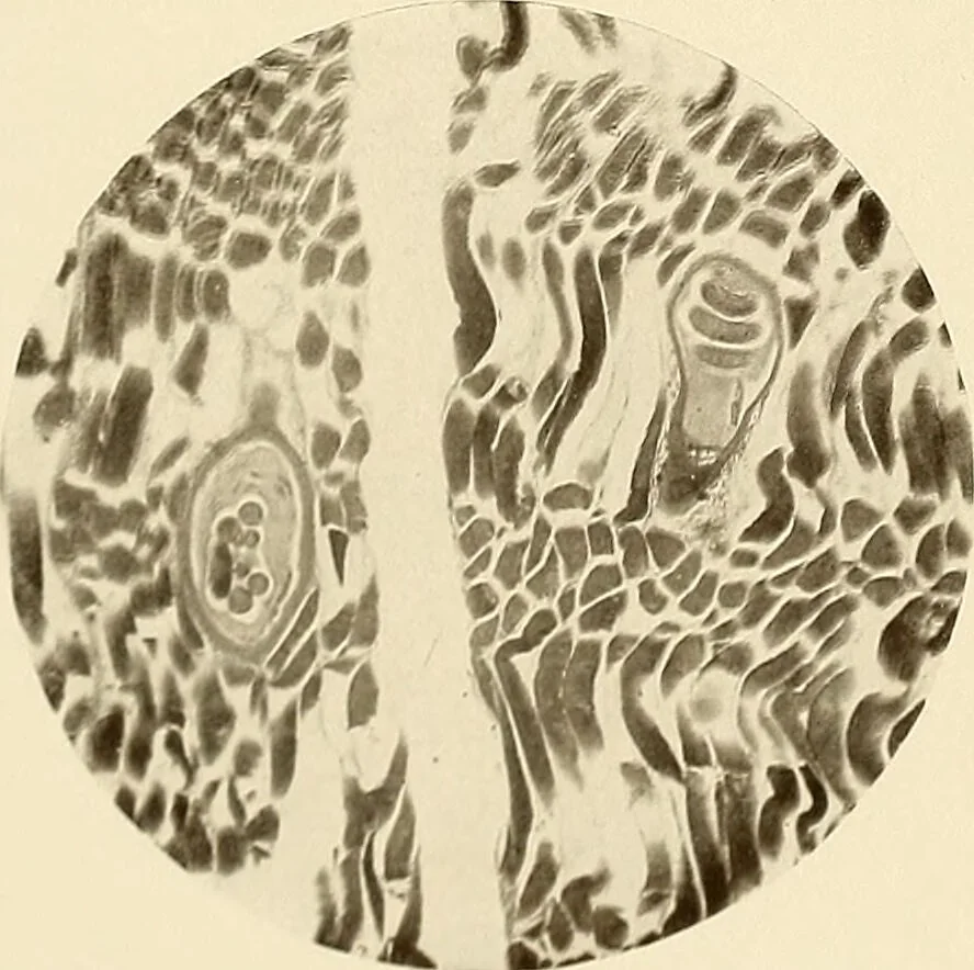 An illustration from A manual of practical hygiene for students, physicians, and health officers / By Charles Harrington., 1914, leaf 51