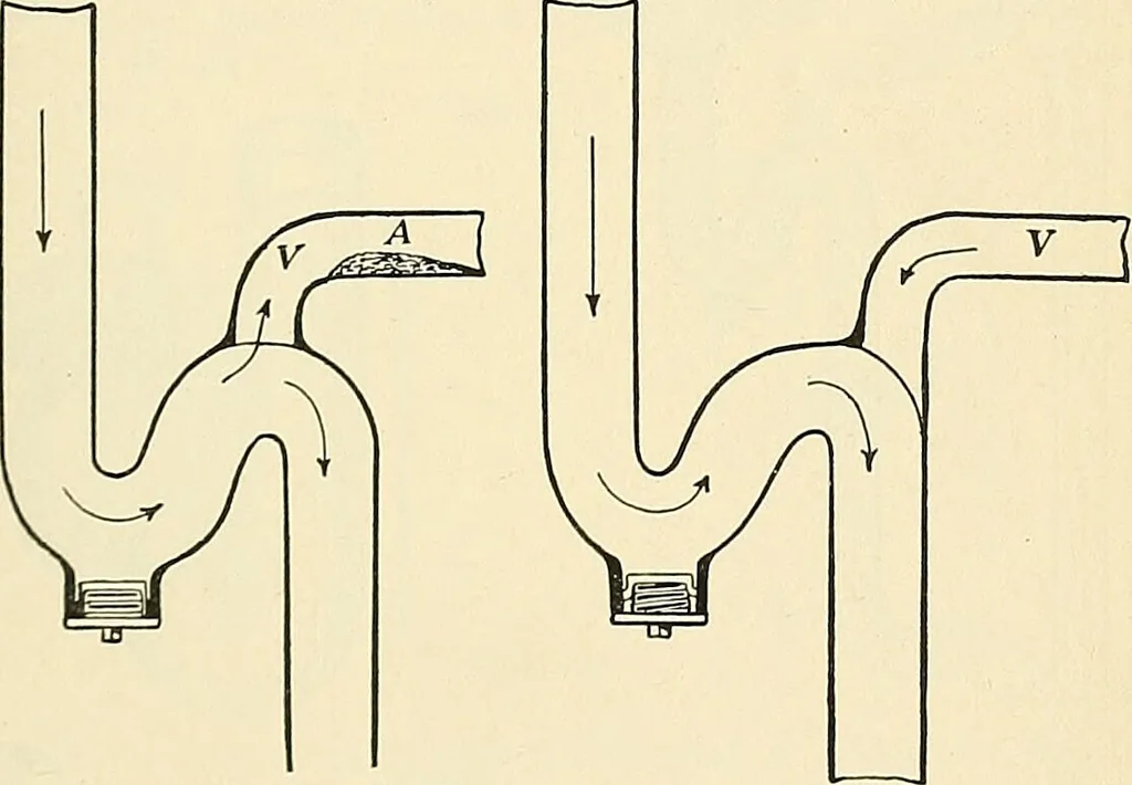 An illustration from A manual of practical hygiene for students, physicians, and health officers / By Charles Harrington., 1914, leaf 579