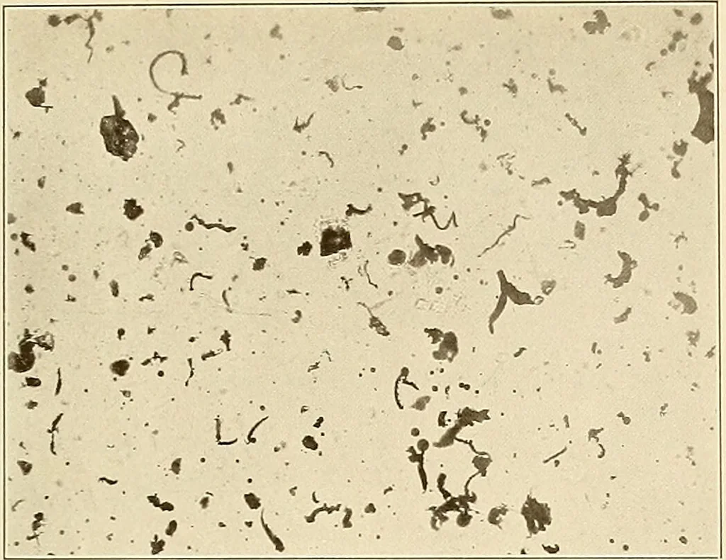 An illustration from A manual of practical hygiene for students, physicians, and health officers / By Charles Harrington., 1914, leaf 687