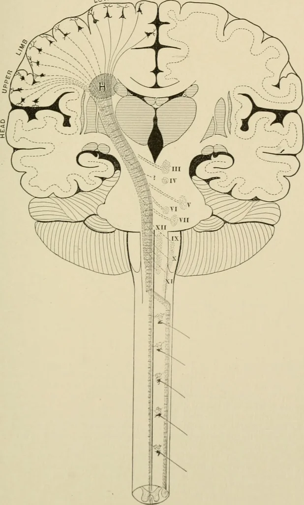 An illustration from Practical diagnosis: the use of symptoms in the diagnosis of disease / By Hobart Amory Hare ... Illustrated with 191 engravings and 13 colored plates., 1896, leaf 117