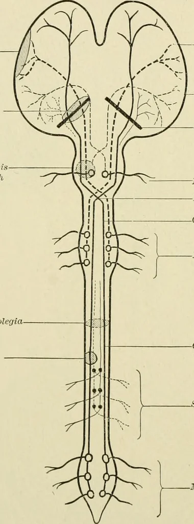 An illustration from Practical diagnosis: the use of symptoms in the diagnosis of disease / By Hobart Amory Hare ... Illustrated with 191 engravings and 13 colored plates., 1896, leaf 122