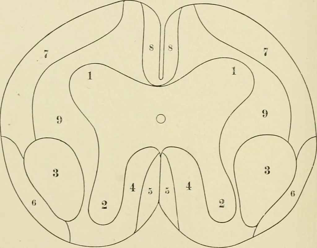 An illustration from Practical diagnosis: the use of symptoms in the diagnosis of disease / By Hobart Amory Hare ... Illustrated with 191 engravings and 13 colored plates., 1896, leaf 124