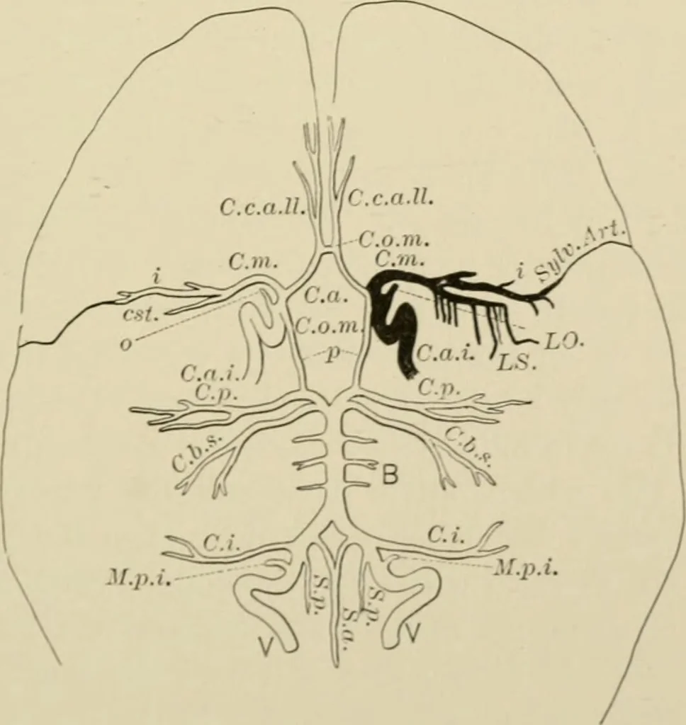An illustration from Practical diagnosis: the use of symptoms in the diagnosis of disease / By Hobart Amory Hare ... Illustrated with 191 engravings and 13 colored plates., 1896, leaf 125
