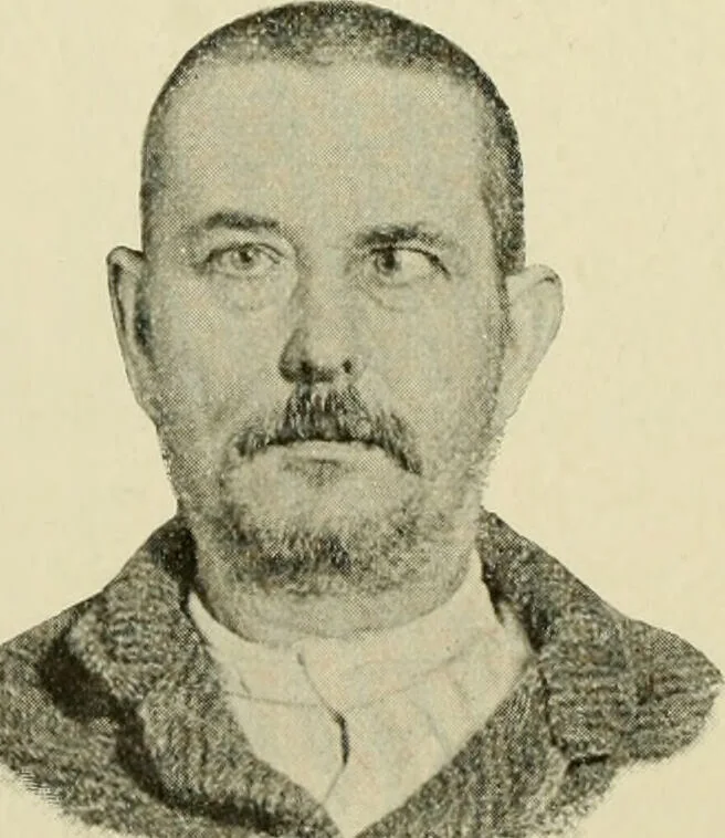 An illustration from Practical diagnosis: the use of symptoms in the diagnosis of disease / By Hobart Amory Hare ... Illustrated with 191 engravings and 13 colored plates., 1896, leaf 156