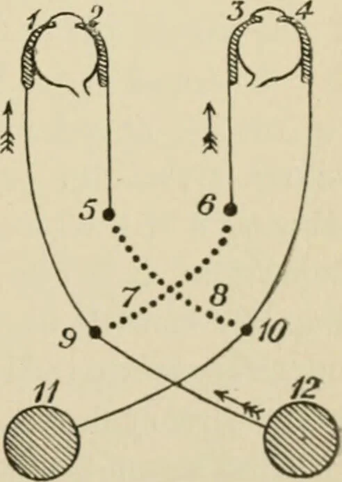 An illustration from Practical diagnosis: the use of symptoms in the diagnosis of disease / By Hobart Amory Hare ... Illustrated with 191 engravings and 13 colored plates., 1896, leaf 167