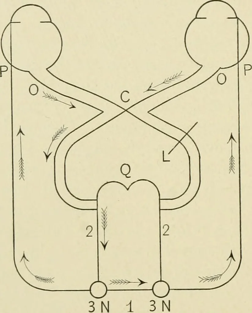 An illustration from Practical diagnosis: the use of symptoms in the diagnosis of disease / By Hobart Amory Hare ... Illustrated with 191 engravings and 13 colored plates., 1896, leaf 170