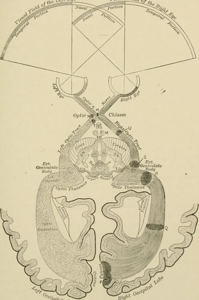 An illustration from Practical diagnosis: the use of symptoms in the diagnosis of disease / By Hobart Amory Hare ... Illustrated with 191 engravings and 13 colored plates., 1896, leaf 173
