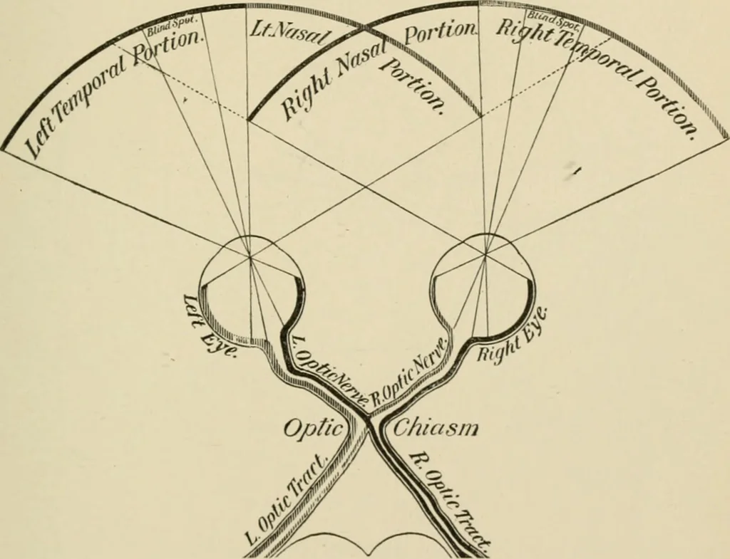 An illustration from Practical diagnosis: the use of symptoms in the diagnosis of disease / By Hobart Amory Hare ... Illustrated with 191 engravings and 13 colored plates., 1896, leaf 175