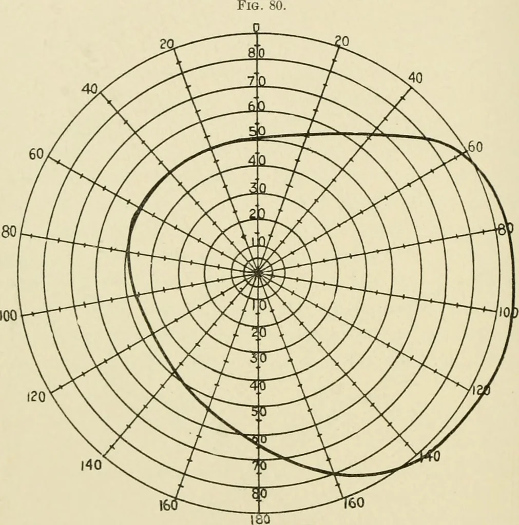An illustration from Practical diagnosis: the use of symptoms in the diagnosis of disease / By Hobart Amory Hare ... Illustrated with 191 engravings and 13 colored plates., 1896, leaf 176