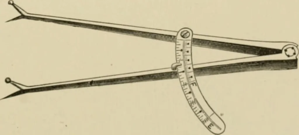 An illustration from Practical diagnosis: the use of symptoms in the diagnosis of disease / By Hobart Amory Hare ... Illustrated with 191 engravings and 13 colored plates., 1896, leaf 229