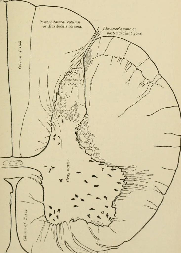 An illustration from Practical diagnosis: the use of symptoms in the diagnosis of disease / By Hobart Amory Hare ... Illustrated with 191 engravings and 13 colored plates., 1896, leaf 231