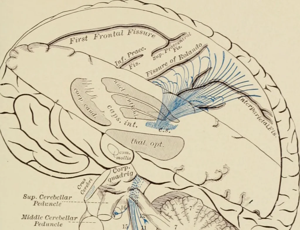 An illustration from Practical diagnosis: the use of symptoms in the diagnosis of disease / By Hobart Amory Hare ... Illustrated with 191 engravings and 13 colored plates., 1896, leaf 233