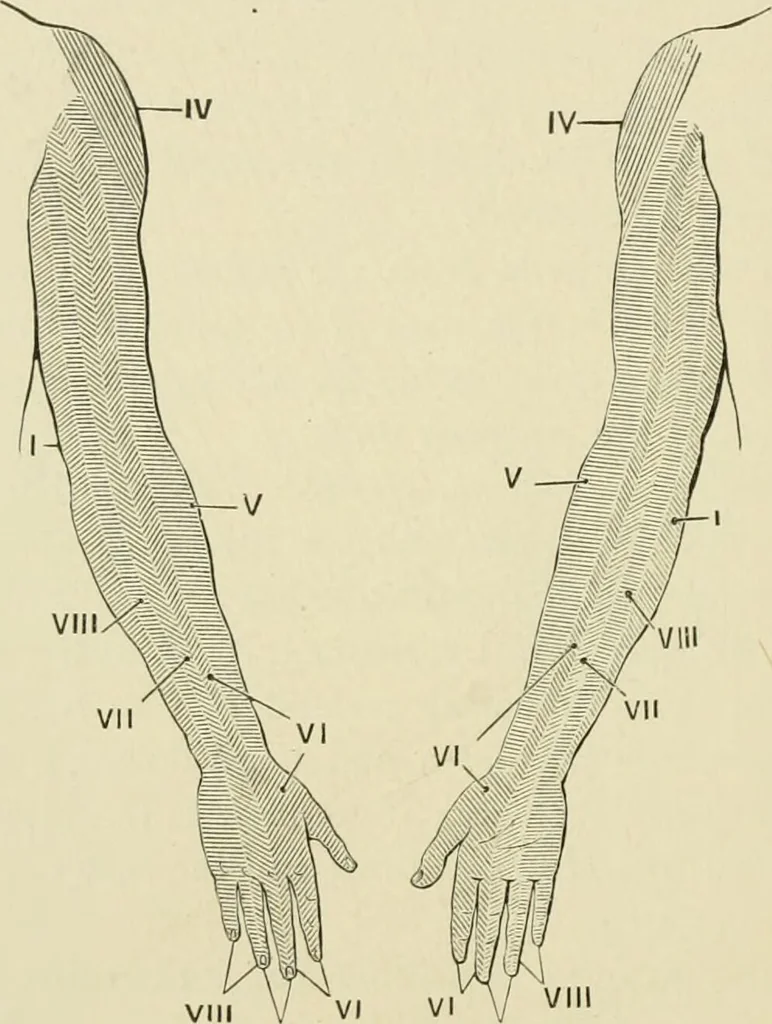 An illustration from Practical diagnosis: the use of symptoms in the diagnosis of disease / By Hobart Amory Hare ... Illustrated with 191 engravings and 13 colored plates., 1896, leaf 246