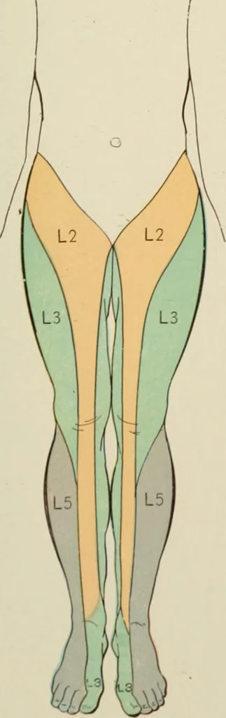An illustration from Practical diagnosis: the use of symptoms in the diagnosis of disease / By Hobart Amory Hare ... Illustrated with 191 engravings and 13 colored plates., 1896, leaf 249