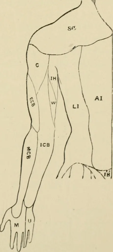 An illustration from Practical diagnosis: the use of symptoms in the diagnosis of disease / By Hobart Amory Hare ... Illustrated with 191 engravings and 13 colored plates., 1896, leaf 255