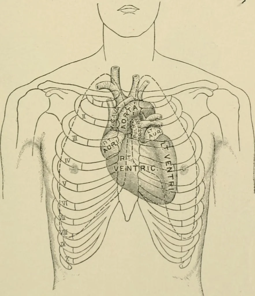 An illustration from Practical diagnosis: the use of symptoms in the diagnosis of disease / By Hobart Amory Hare ... Illustrated with 191 engravings and 13 colored plates., 1896, leaf 265