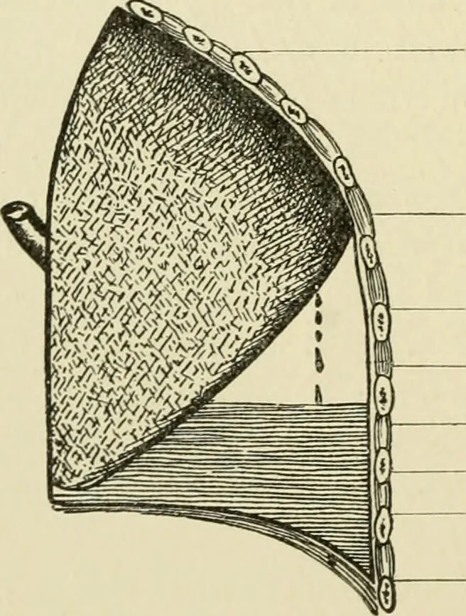 An illustration from Practical diagnosis: the use of symptoms in the diagnosis of disease / By Hobart Amory Hare ... Illustrated with 191 engravings and 13 colored plates., 1896, leaf 276