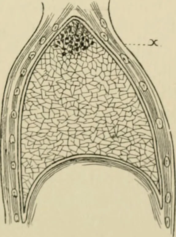 An illustration from Practical diagnosis: the use of symptoms in the diagnosis of disease / By Hobart Amory Hare ... Illustrated with 191 engravings and 13 colored plates., 1896, leaf 277