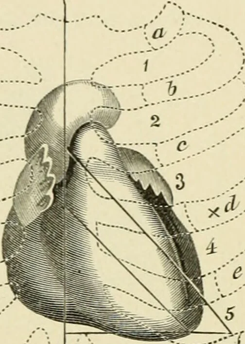 An illustration from Practical diagnosis: the use of symptoms in the diagnosis of disease / By Hobart Amory Hare ... Illustrated with 191 engravings and 13 colored plates., 1896, leaf 280