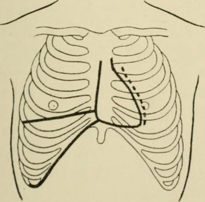 An illustration from Practical diagnosis: the use of symptoms in the diagnosis of disease / By Hobart Amory Hare ... Illustrated with 191 engravings and 13 colored plates., 1896, leaf 283