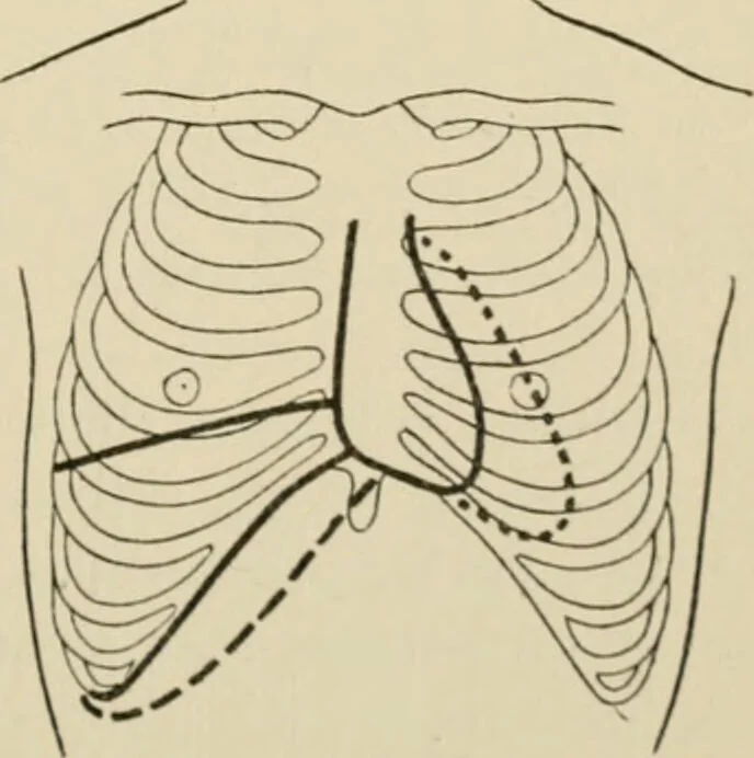 An illustration from Practical diagnosis: the use of symptoms in the diagnosis of disease / By Hobart Amory Hare ... Illustrated with 191 engravings and 13 colored plates., 1896, leaf 283