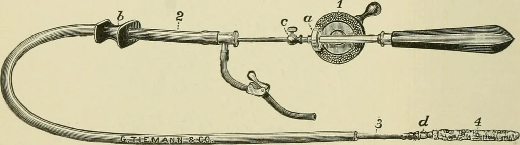 An illustration from Practical diagnosis: the use of symptoms in the diagnosis of disease / By Hobart Amory Hare ... Illustrated with 191 engravings and 13 colored plates., 1896, leaf 324