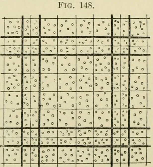 An illustration from Practical diagnosis: the use of symptoms in the diagnosis of disease / By Hobart Amory Hare ... Illustrated with 191 engravings and 13 colored plates., 1896, leaf 352