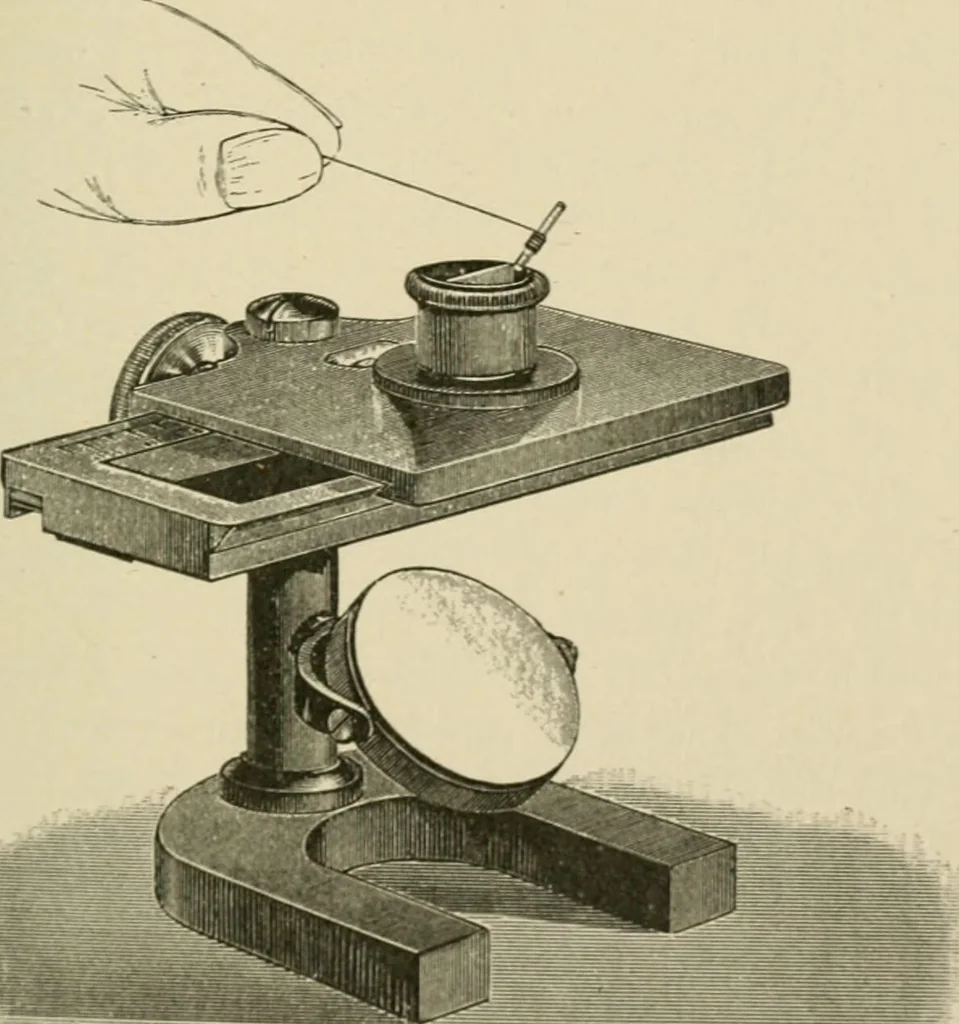 An illustration from Practical diagnosis: the use of symptoms in the diagnosis of disease / By Hobart Amory Hare ... Illustrated with 191 engravings and 13 colored plates., 1896, leaf 357
