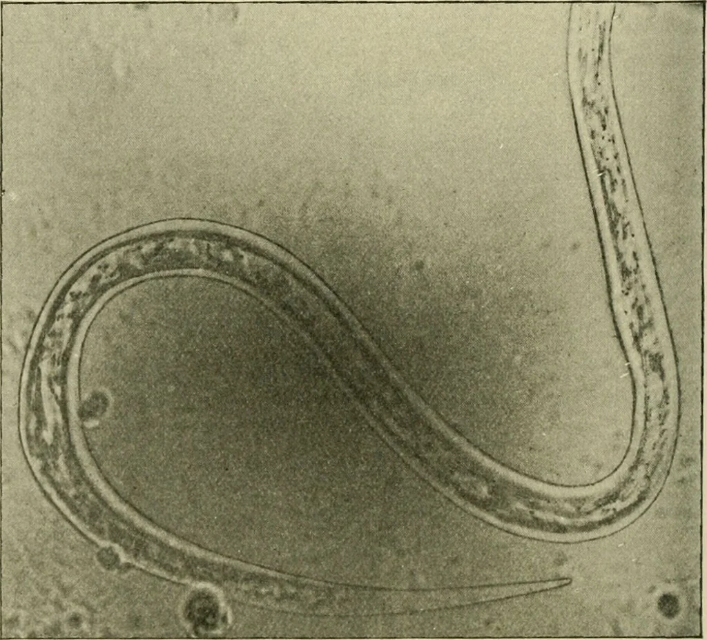 An illustration from Practical diagnosis: the use of symptoms in the diagnosis of disease / By Hobart Amory Hare ... Illustrated with 191 engravings and 13 colored plates., 1896, leaf 374