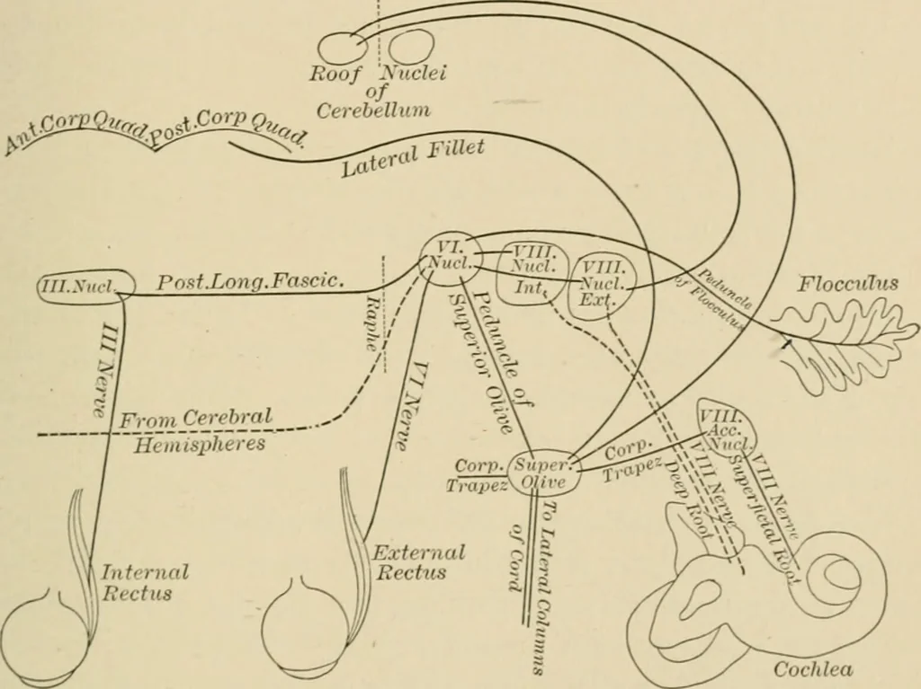 An illustration from Practical diagnosis: the use of symptoms in the diagnosis of disease / By Hobart Amory Hare ... Illustrated with 191 engravings and 13 colored plates., 1896, leaf 39