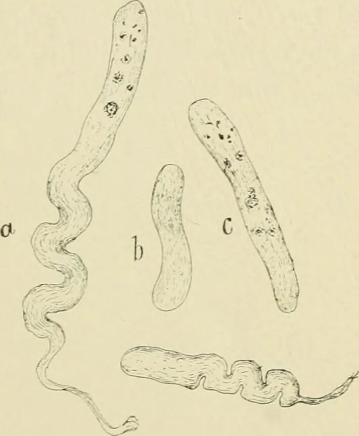An illustration from Practical diagnosis: the use of symptoms in the diagnosis of disease / By Hobart Amory Hare ... Illustrated with 191 engravings and 13 colored plates., 1896, leaf 396