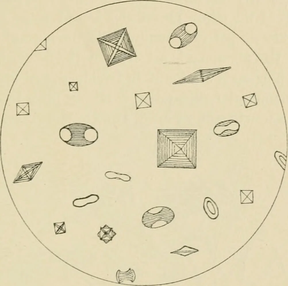 An illustration from Practical diagnosis: the use of symptoms in the diagnosis of disease / By Hobart Amory Hare ... Illustrated with 191 engravings and 13 colored plates., 1896, leaf 399