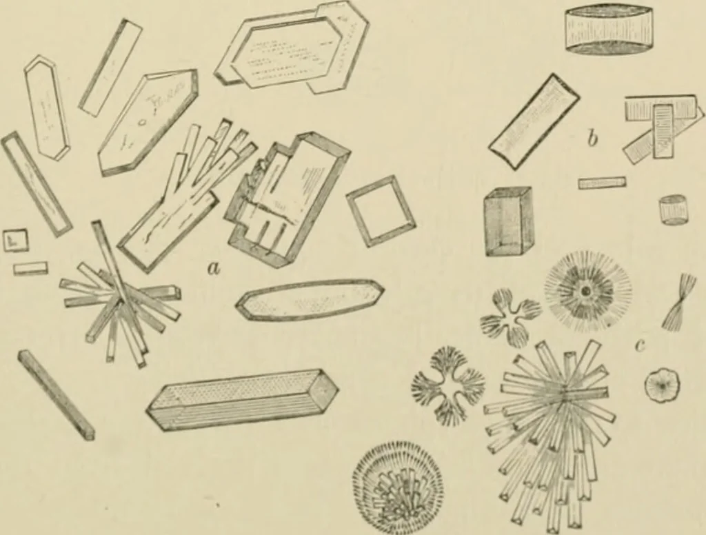 An illustration from Practical diagnosis: the use of symptoms in the diagnosis of disease / By Hobart Amory Hare ... Illustrated with 191 engravings and 13 colored plates., 1896, leaf 399