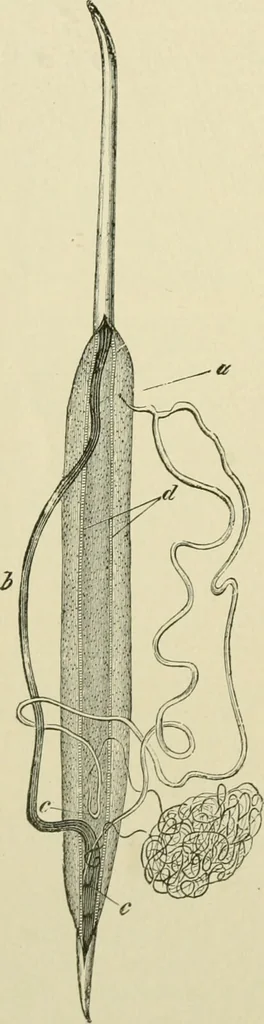An illustration from Practical diagnosis: the use of symptoms in the diagnosis of disease / By Hobart Amory Hare ... Illustrated with 191 engravings and 13 colored plates., 1896, leaf 430