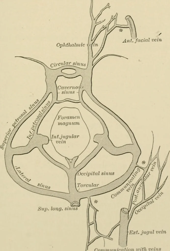 An illustration from Practical diagnosis: the use of symptoms in the diagnosis of disease / By Hobart Amory Hare ... Illustrated with 191 engravings and 13 colored plates., 1896, leaf 465