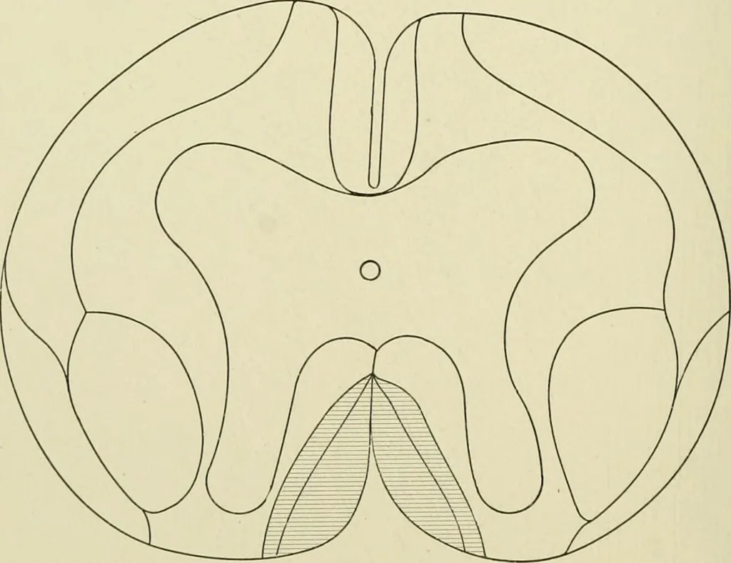 An illustration from Practical diagnosis: the use of symptoms in the diagnosis of disease / By Hobart Amory Hare ... Illustrated with 191 engravings and 13 colored plates., 1896, leaf 78