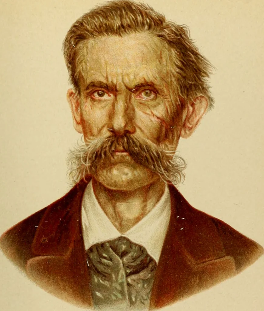 An illustration from Atlas and epitome of diseases caused by accidents / by Dr. Ed. Golebiewski ... authorized translation from the German, with editorial notes and additions by Pearce Bailey ... 40 colored plates, and 143 illustrations in black., 1900, leaf 123