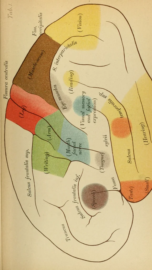 An illustration from Atlas and epitome of diseases caused by accidents / by Dr. Ed. Golebiewski ... authorized translation from the German, with editorial notes and additions by Pearce Bailey ... 40 colored plates, and 143 illustrations in black., 1900, leaf 85