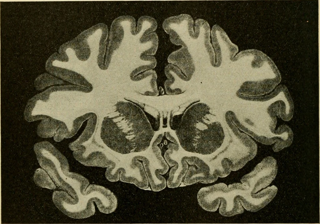 An illustration from Handbook of physiology : for students and practitioners of medicine / by Austin Flint ... with two hundred and forty-seven illustrations in the text--including four in colors--and an atlas of sixteen color-plates, including forty-eight original figures taken from actual stained microscopical preparation., 1905, leaf 614