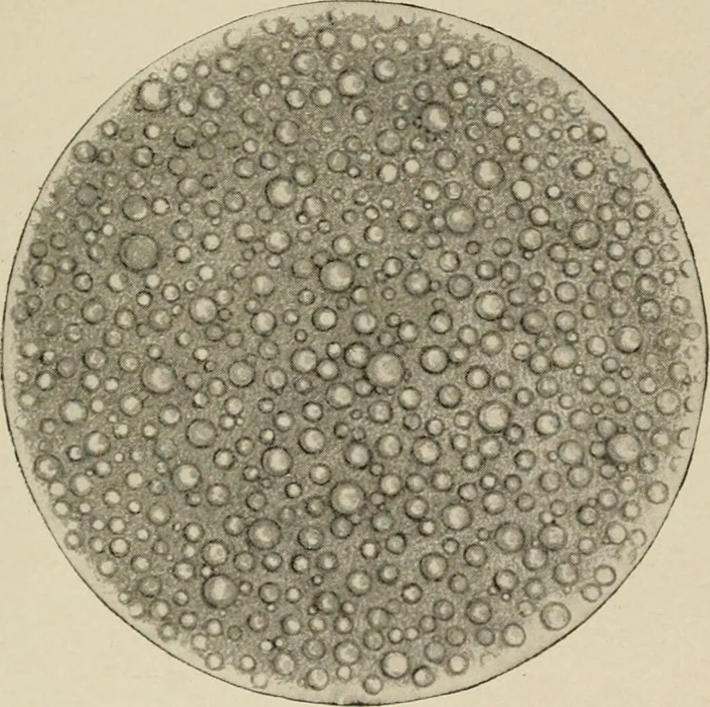 An illustration from Diseases of infancy and childhood, their dietetic, hygienic, and medical treatment : a text-book designed for practitioners and students in medicine / By Louis Fischer., 1910, leaf 103