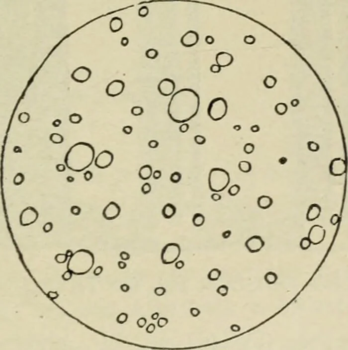 An illustration from Diseases of infancy and childhood, their dietetic, hygienic, and medical treatment : a text-book designed for practitioners and students in medicine / By Louis Fischer., 1910, leaf 115