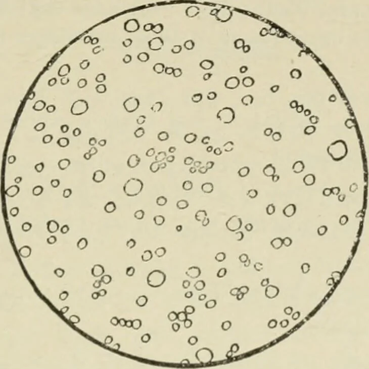 An illustration from Diseases of infancy and childhood, their dietetic, hygienic, and medical treatment : a text-book designed for practitioners and students in medicine / By Louis Fischer., 1910, leaf 125