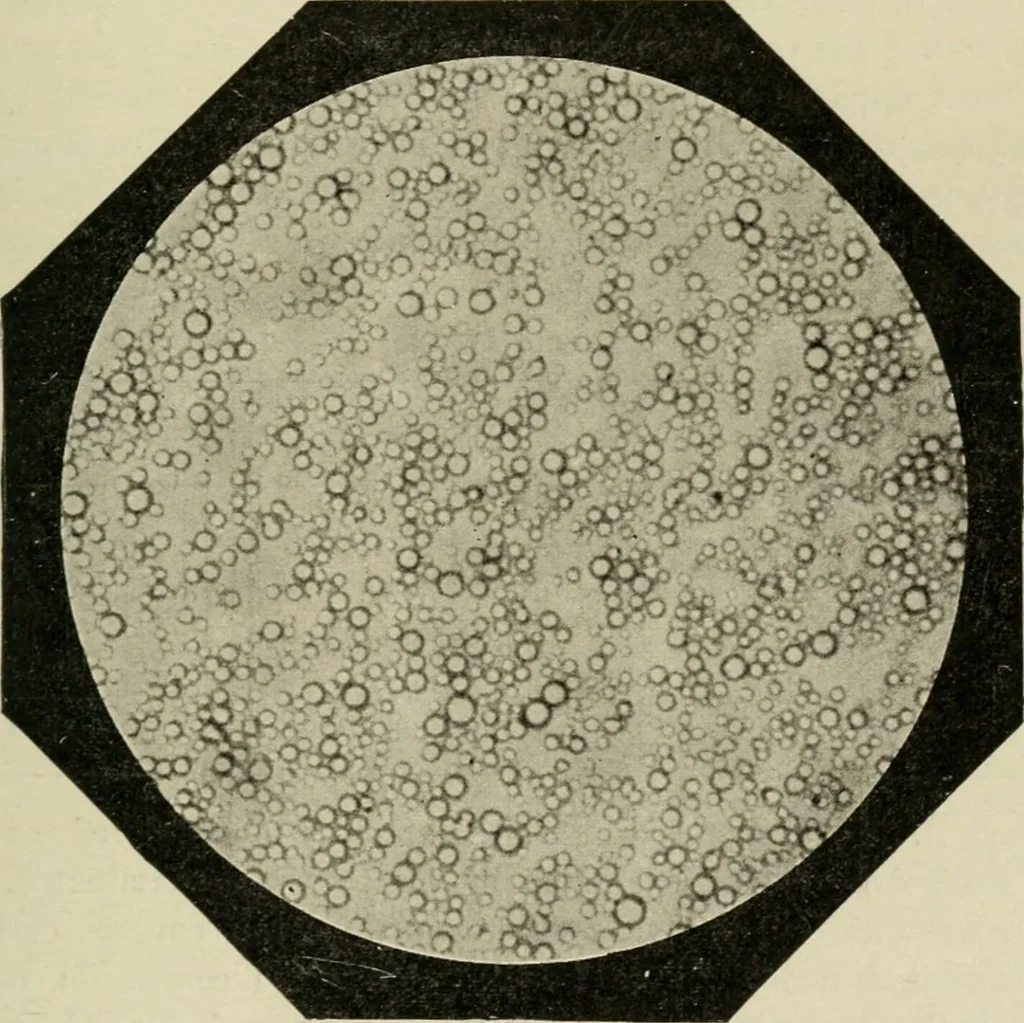 An illustration from Diseases of infancy and childhood, their dietetic, hygienic, and medical treatment : a text-book designed for practitioners and students in medicine / By Louis Fischer., 1910, leaf 159