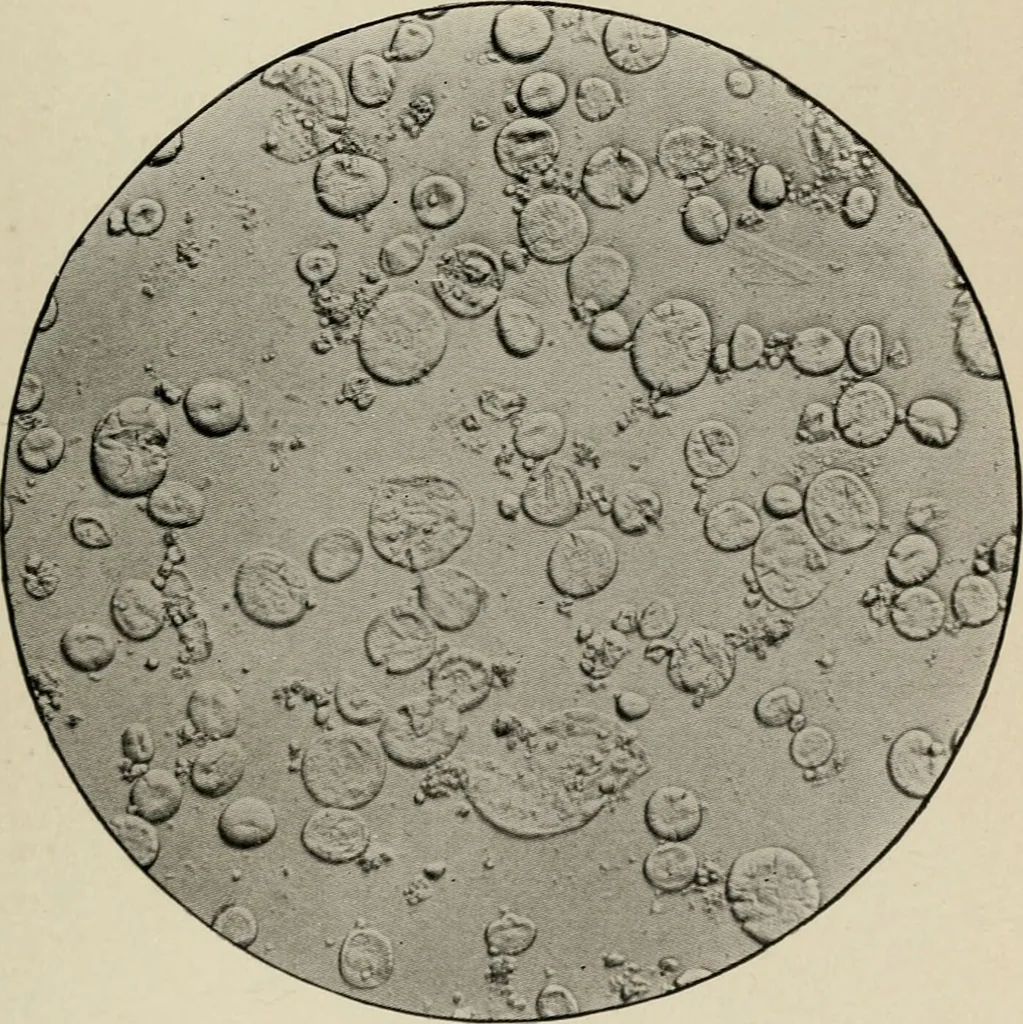 An illustration from Diseases of infancy and childhood, their dietetic, hygienic, and medical treatment : a text-book designed for practitioners and students in medicine / By Louis Fischer., 1910, leaf 169