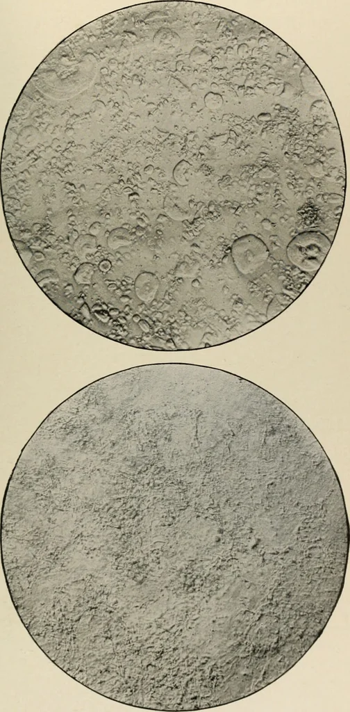 An illustration from Diseases of infancy and childhood, their dietetic, hygienic, and medical treatment : a text-book designed for practitioners and students in medicine / By Louis Fischer., 1910, leaf 171