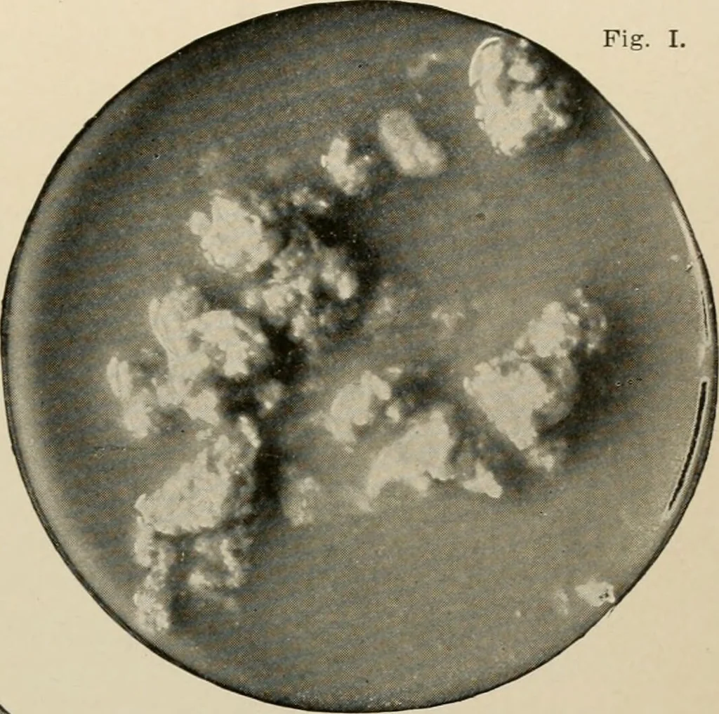 An illustration from Diseases of infancy and childhood, their dietetic, hygienic, and medical treatment : a text-book designed for practitioners and students in medicine / By Louis Fischer., 1910, leaf 297