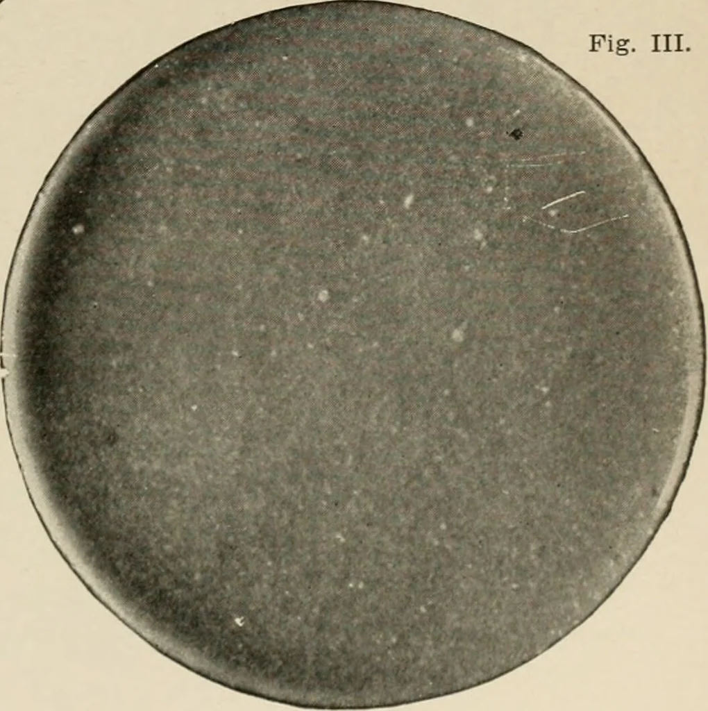 An illustration from Diseases of infancy and childhood, their dietetic, hygienic, and medical treatment : a text-book designed for practitioners and students in medicine / By Louis Fischer., 1910, leaf 297
